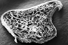 Optic nerve